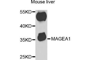 Western blot analysis of extracts of mouse liver, using MAGEA1 antibody (ABIN5973183) at 1/1000 dilution. (MAGEA1 anticorps)