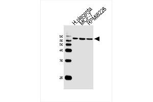Lane 1: Sample Tissue/Cell lysates, Lane 2: Sample Tissue/Cell lysates, Lane 3: Sample Tissue/Cell lysates, probed with antibodyname Monoclonal Antibody, unconjugated (bsm-51388M) at 1:1000 overnight at 4°C followed by a conjugated secondary antibody for 60 minutes at 37°C. (RPS6KB2 anticorps)