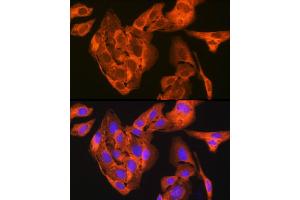 Immunofluorescence analysis of U-2 OS cells using JNK1/JNK3 Rabbit mAb (ABIN1678909, ABIN7101754, ABIN7101755 and ABIN7101756) at dilution of 1:100 (40x lens). (JNK anticorps)