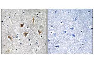 Immunohistochemistry (IHC) image for anti-Mitochondrial Transcription Termination Factor (MTERF) (Internal Region) antibody (ABIN1852304) (MTERF anticorps  (Internal Region))