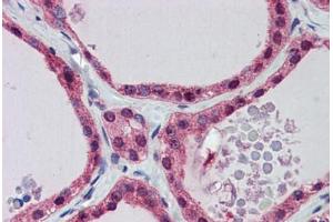 Human Thyroid: Formalin-Fixed, Paraffin-Embedded (FFPE)
