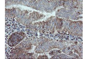 Image no. 6 for anti-NADH Dehydrogenase (Ubiquinone) 1 beta Subcomplex, 10, 22kDa (NDUFB10) antibody (ABIN1499668)