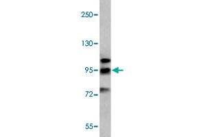 Western blot analysis of K-562 cell lysate (35 ug/lane) with GRM6 polyclonal antibody . (Metabotropic Glutamate Receptor 6 anticorps  (C-Term))