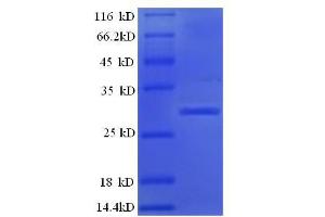 Kallikrein B, Plasma (Fletcher Factor) 1 (KLKB1) (AA 391-638), (Light Chain) protein (His tag)
