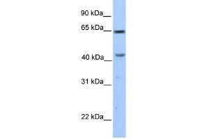 WB Suggested Anti-CCDC60 Antibody Titration: 0. (CCDC60 anticorps  (C-Term))