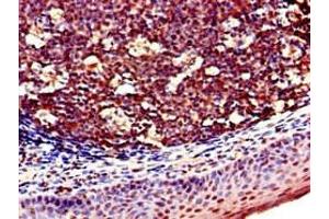 Immunohistochemistry of paraffin-embedded human tonsil tissue using ABIN7161085 at dilution of 1:100