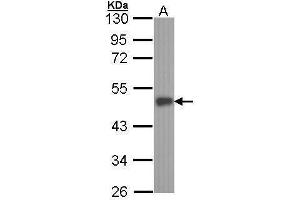 WB Image Sample (30 ug of whole cell lysate) A: A431 , 10% SDS PAGE antibody diluted at 1:1000