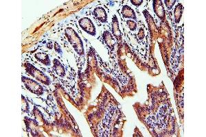 IHC analysis of TDRD3 using anti-TDRD3 antibody (ABIN6719636).