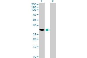 Western Blot analysis of HSD17B14 expression in transfected 293T cell line by HSD17B14 MaxPab polyclonal antibody. (HSD17B14 anticorps  (AA 1-270))
