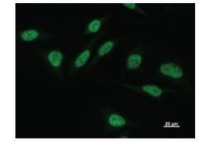Immunostaining analysis in HeLa cells. (POU2F1 anticorps)