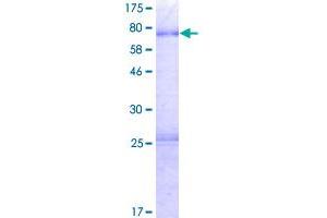 Image no. 1 for Protein Interacting with Cyclin A1 (PROCA1) (AA 1-336) protein (GST tag) (ABIN1316359)