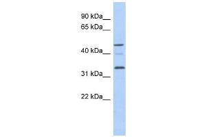 Cyclin Y-Like 1 antibody used at 1 ug/ml to detect target protein. (CCNYL1 anticorps  (N-Term))