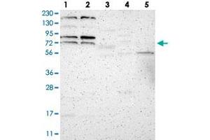 Western blot analysis of Lane 1: RT-4, Lane 2: U-251 MG, Lane 3: Human Plasma, Lane 4: Liver, Lane 5: Tonsil with ZNF90 polyclonal antibody . (ZNF90 anticorps)