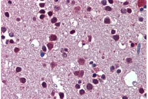 Human Brain, Cortex: Formalin-Fixed, Paraffin-Embedded (FFPE)