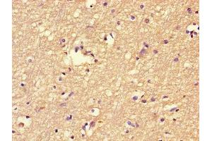 Immunohistochemistry of paraffin-embedded human brain tissue using ABIN7152464 at dilution of 1:100 (FBXL18 anticorps  (AA 1-365))