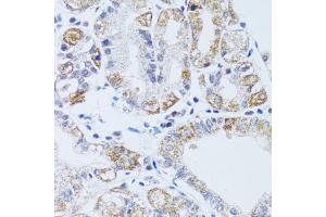 Immunohistochemistry of paraffin-embedded human stomach using DNAJC19 antibody (ABIN1876363) at dilution of 1:100 (40x lens). (DNAJC19 anticorps)
