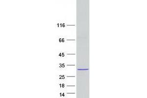 Validation with Western Blot