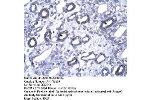 Human kidney (FOXP1 anticorps  (N-Term))