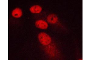 ABIN6266578 staining MCF-7 cells by ICC/IF. (Ki-67 anticorps  (Internal Region))