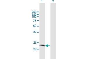 Western Blot analysis of RAB38 expression in transfected 293T cell line by RAB38 MaxPab polyclonal antibody. (RAB38 anticorps  (AA 1-211))