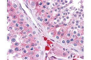 GSTM1 antibody was used for immunohistochemistry at a concentration of 4-8 ug/ml. (GSTM1 anticorps  (C-Term))