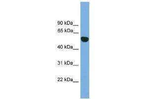 WB Suggested Anti-EPHX1 Antibody Titration: 0. (EPHX1 anticorps  (N-Term))