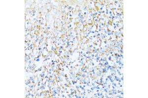 Immunohistochemistry of paraffin-embedded human tonsil using NDUF antibody (ABIN7268804) at dilution of 1:100 (40x lens).