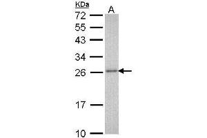 WB Image Sample (30 ug of whole cell lysate) A: Molt-4 , 12% SDS PAGE antibody diluted at 1:1000 (PSMA3 anticorps  (Center))