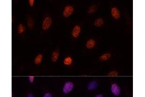 Immunofluorescence analysis of U-2OS cells using PCGF1 Polyclonal Antibody at dilution of 1:100. (PCGF1 anticorps)