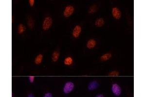 Immunofluorescence analysis of U-2OS cells using PCGF1 Polyclonal Antibody at dilution of 1:100.