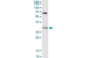DKK1 monoclonal antibody (M06), clone 4C10.