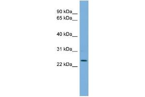 WB Suggested Anti-THAP6 Antibody Titration: 0. (THAP6 anticorps  (Middle Region))