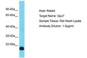 Image no. 1 for anti-Glutathione Peroxidase 7 (GPX7) (AA 105-154) antibody (ABIN6750347) (Glutathione Peroxidase 7 anticorps  (AA 105-154))