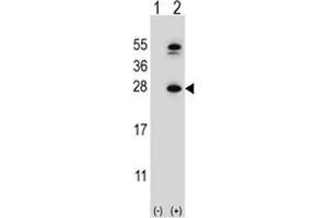 Western blot analysis of DHFR antibody and 293 cell lysate either nontransfected (Lane 1) or transiently transfected (2) with the DHFR gene. (Dihydrofolate Reductase anticorps  (AA 135-164))