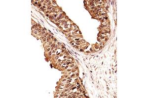 Immunohistochemical analysis of paraffin-embedded H. (ECE2 anticorps  (AA 551-579))