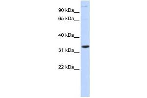 Western Blotting (WB) image for anti-Acidic (Leucine-Rich) Nuclear phosphoprotein 32 Family, Member B (ANP32B) antibody (ABIN2459518) (ANP32B anticorps)