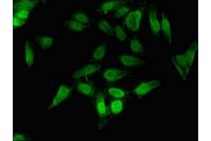 Immunofluorescent analysis of Hela cells using ABIN7148687 at dilution of 1:100 and Alexa Fluor 488-congugated AffiniPure Goat Anti-Rabbit IgG(H+L)