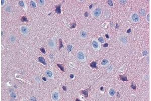 Mouse Brain, Cortex (formalin-fixed, paraffin-embedded) stained with GNAO1 antibody ABIN462341 followed by biotinylated goat anti-rabbit IgG secondary antibody ABIN481713, alkaline phosphatase-streptavidin and chromogen.