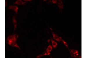ABIN6274902 staining NIH-3T3 by IF/ICC. (GCNT6 anticorps)