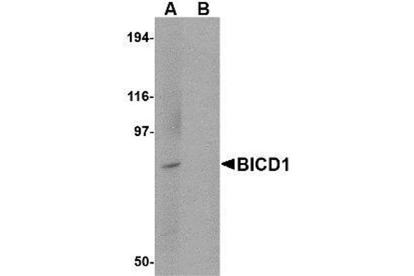 BICD1 抗体  (C-Term)