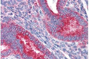 Human Uterus: Formalin-Fixed, Paraffin-Embedded (FFPE) (MVP anticorps  (AA 1-894))