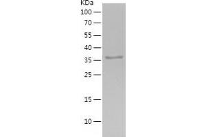 Western Blotting (WB) image for Hemoglobin beta (HBB) (AA 1-147) protein (His-IF2DI Tag) (ABIN7123292)
