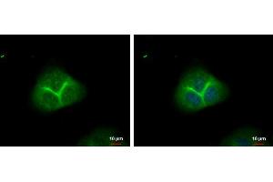 ICC/IF Image alpha Adducin antibody detects alpha Adducin protein at membrane by immunofluorescent analysis. (alpha Adducin anticorps)