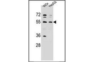 Western blot analysis of NARS Antibody (N-term) in WiDr, HepG2 cell line lysates (35ug/lane).