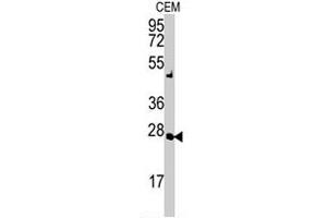 Western blot analysis of AK2 polyclonal antibody  in CEM cell lysate (35 ug/lane).