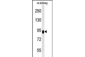 ZBTB41 Antibody (Center) (ABIN654501 and ABIN2844232) western blot analysis in mouse kidney tissue lysates (35 μg/lane). (ZBTB41 anticorps  (AA 263-292))