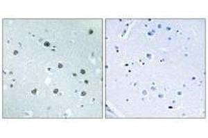 Immunohistochemistry analysis of paraffin-embedded human brain tissue using MYO1D antibody. (Myosin ID anticorps)