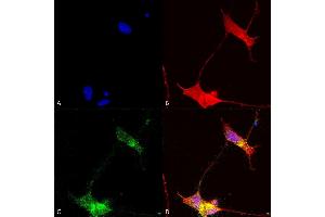 Immunocytochemistry/Immunofluorescence analysis using Mouse Anti-SHANK (pan) Monoclonal Antibody, Clone S23b-49 (ABIN2484048). (SHANK2 anticorps  (AA 84-309) (APC))