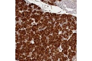 Immunohistochemical staining of human pancreas with HARBI1 polyclonal antibody  shows strong cytoplasmic positivity in exocrine glandular cells at 1:500-1:1000 dilution. (HARBI1 anticorps)