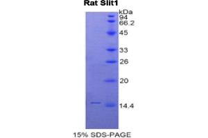 SDS-PAGE analysis of Rat Slit Homolog 1 Protein. (SLIT1 Protéine)